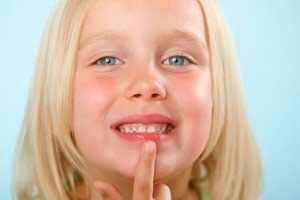 Причины почему сохнут губы у детей