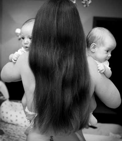 почему очень сильно выпадают волосы после родов