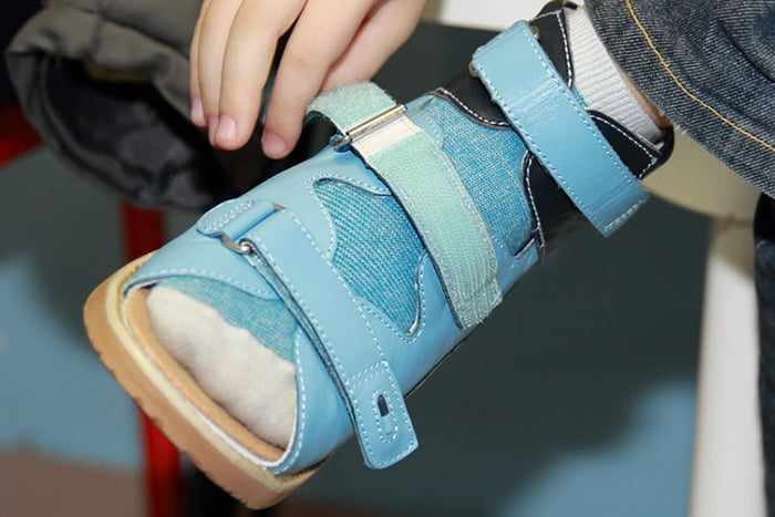 Ортопедическая обувь у ребенка